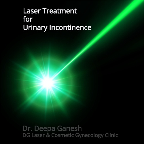 Co2 Laser Therapy For Management Of Stress Urinary Incontinence In Co2 Laser Therapy For Management Of Stress Urinary Incontinence In