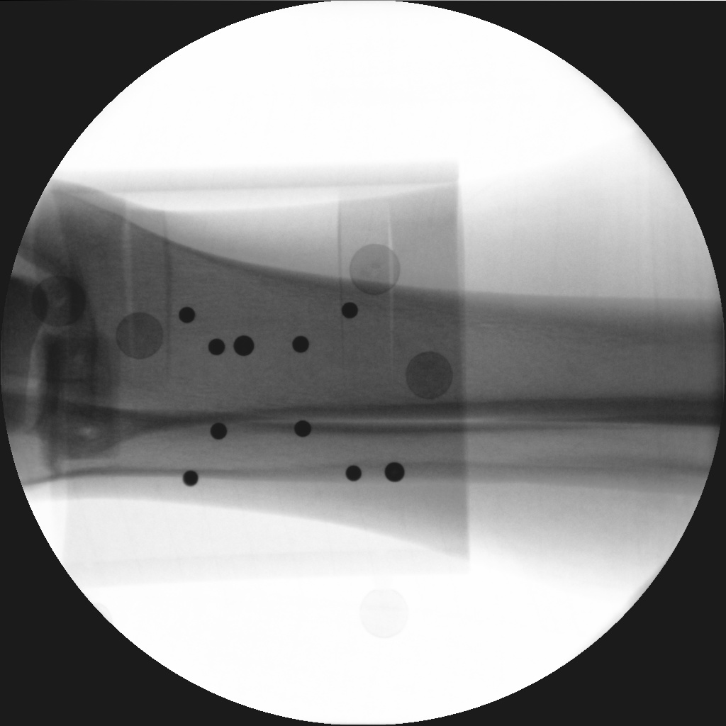 Understanding X-Ray Saturation Point: A Quick Guide