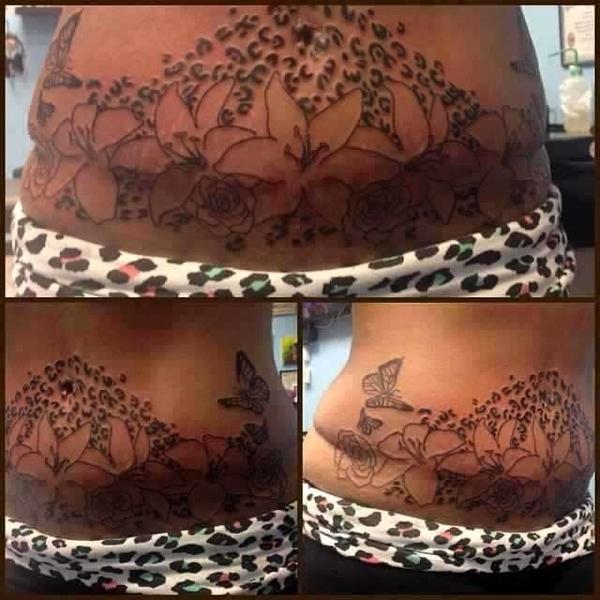 Tummy Tuck Scar Tattoo Ideas Tummy Tuck Scar Tattoo Ideas