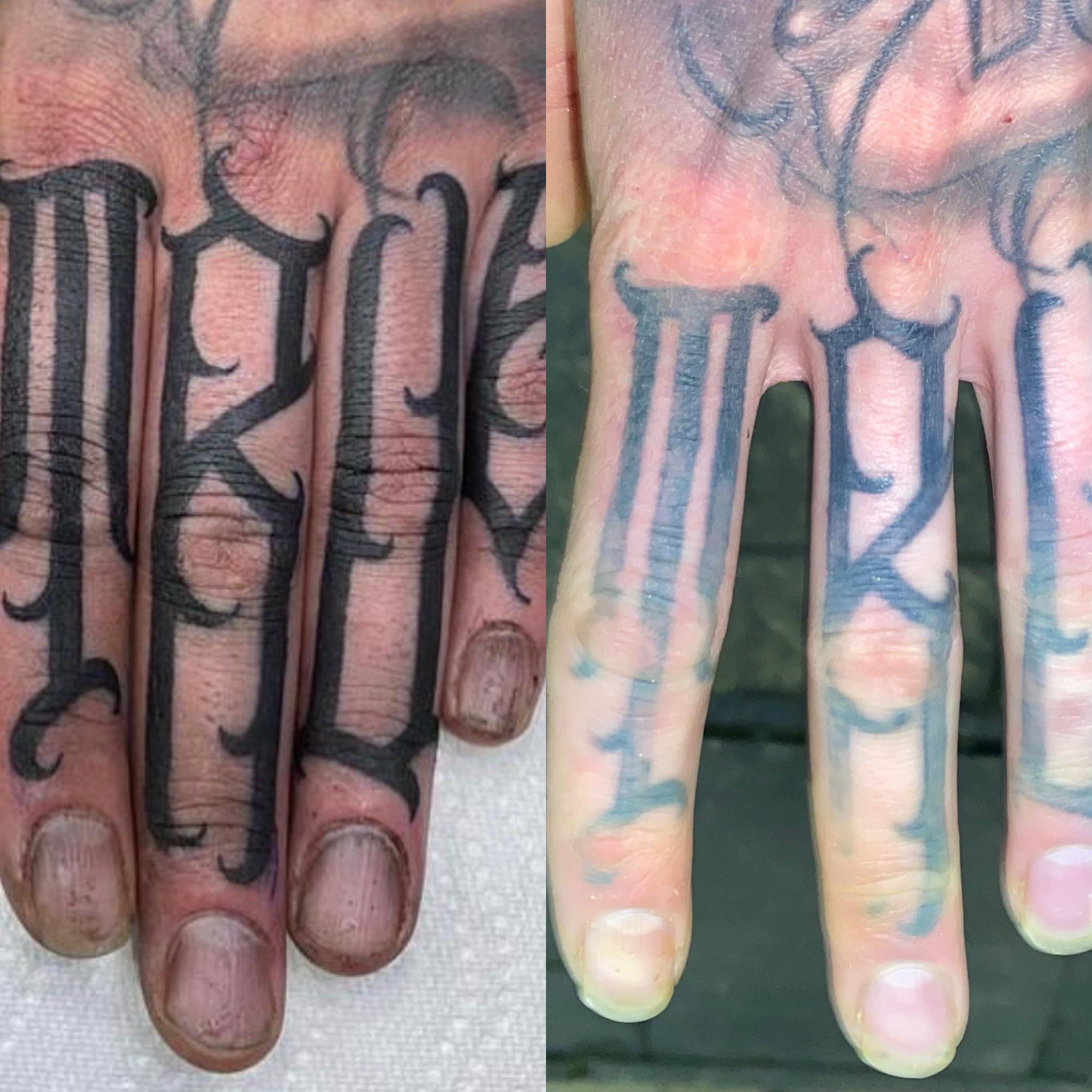 Update More Than 69 Heal Finger Tattoo Latest In Cdgdbentre Update More Than 69 Heal Finger Tattoo Latest In Cdgdbentre